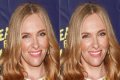 Toni Collette Teeth Before And After | What Is Wrong With Her Face
